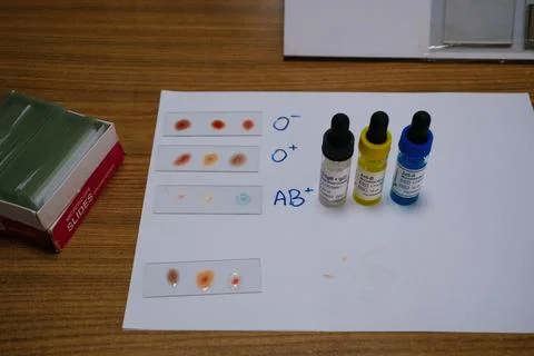 Blood type testing setup in a laboratory 库存照片