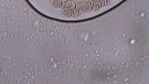 Blood under a microscope. Conditionally pathogenic bacteria in blood plasma 스톡 동영상 71548951