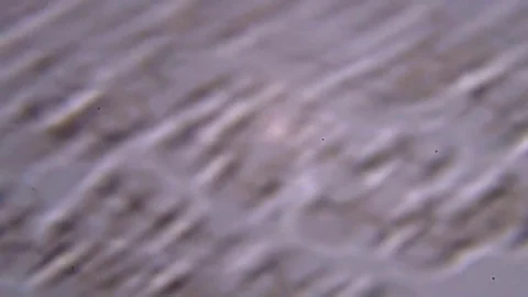 Blood under a microscope. Conditionally pathogenic bacteria in blood plasma Stock Footage 71549673