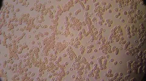 Blood Under Microscope Stock Footage 52841527