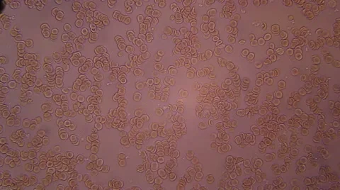 Blood Under Microscope Stock Footage 52842147