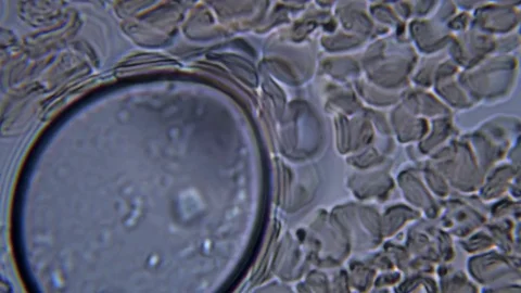 Blood under a microscope. The movement of erythrocytes in the interstitial fluid Stock Footage