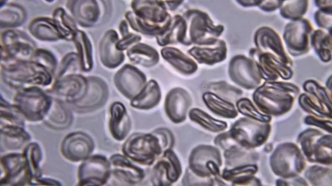 Blood under a microscope. The movement of erythrocytes in the interstitial fluid 스톡 동영상 71551895