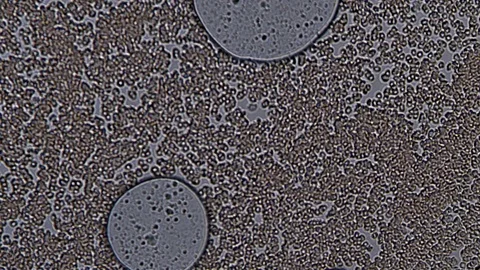 Blood under a microscope. The movement of erythrocytes in the interstitial fluid Stock Footage 71552024