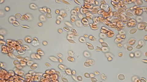 Blood under a microscope, the movement of red blood cells is visible Stock-Footage 127780248