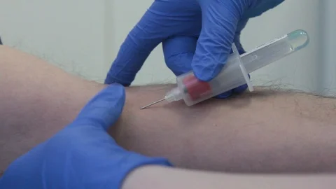 Blood from a vein. Pull out needle with syringe Stock Footage 87072149