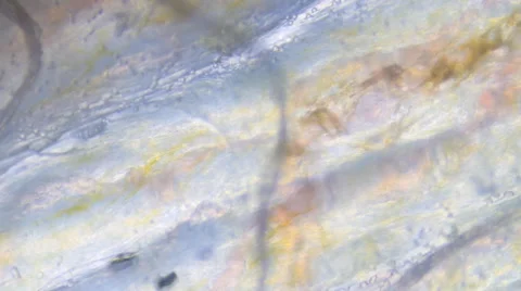 Blood Veins Under Microscope 動画素材 41169964