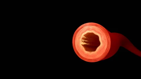 Blood vessel Stock Footage 61536373