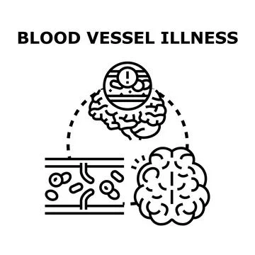 Blood vessel illness causing brain health problems Stock Illustration