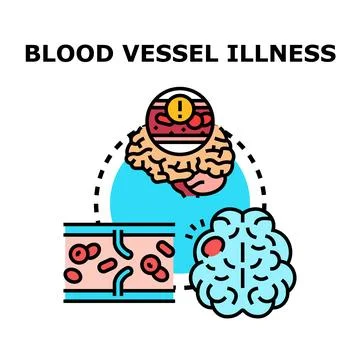 Blood vessel illness causing brain health problems Stock Illustration