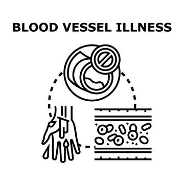 Blood vessel illness concept visualizing various related health conditions Stock Illustration