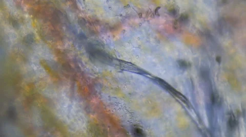 Blood Vessels Close up Stock Footage 42637083