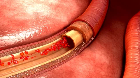 Blood vessels Stock Footage 61794331