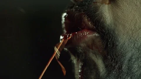 Blood Vomit Stock Footage 85322074