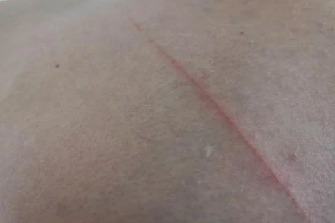 Blooded lesion from sharp knife on men hard skin. Stock Photos