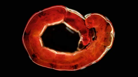 Bloodworm under a microscope, is the larva of a mosquito of the family Stock Footage 105102296