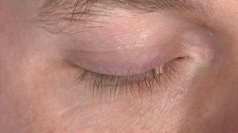 Bloody eye Stock Footage