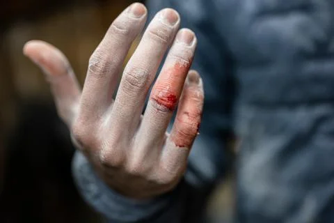A bloody right hand of a male wearing a sweater Stock Photos