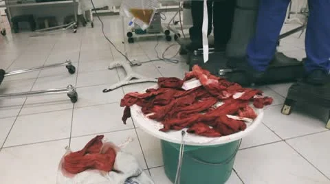 Bloody Surgery Stock Footage 10769245