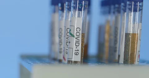 Blue background testing in lab of COVID-19 virus Stock Footage 127651413