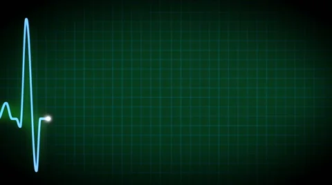 Blue ECG graph Stock-Footage 48761709