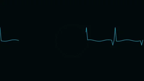 Blue electrocardiogram heart rhythm tracing displayed on a dark background 库存影片 338310780