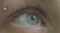 blue eye looks up - macro HD Footage