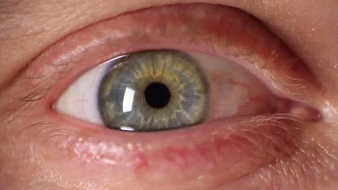 Blue Eye Macro Stock Footage 70875153