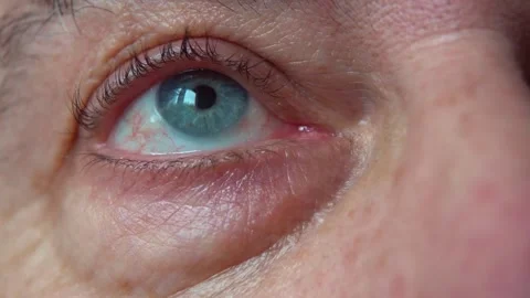 The blue eye of a middle-aged man looks up. Stock Footage 148448488
