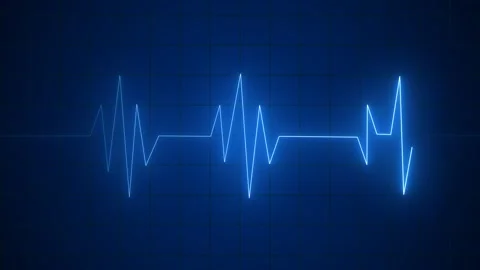 Blue glowing heartbeat pulse on a black grid background Stock Footage 317128408