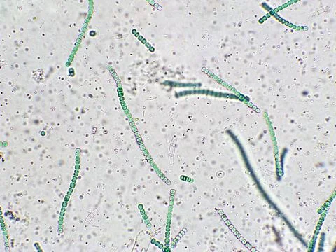 Blue green algae under microscopic view, cyanobacteria Stock Photos