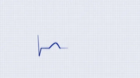 Blue HeartBeat Cardiogram on Grid Background. Stock Footage 58882667
