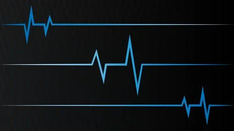 Blue Heartbeat Line Pattern on a Black Grid Background Illustrazione stock
