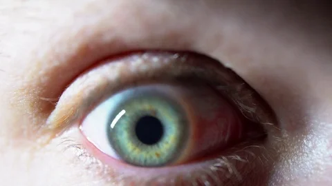 Blue Human Eye Iris Dilating And Being Scared And Cautious Video stock 84666605