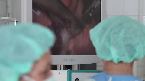 Blurred surgeon and assistant makes an operation through a monitor. 스톡 동영상 80967807