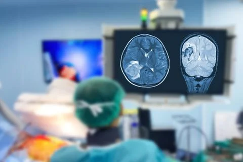 Blurry Close-Up Back Shot in the Operating Room Stock Photos