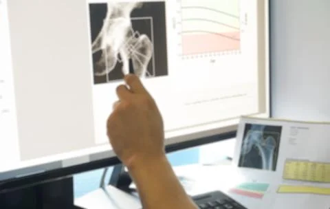 Blurry close up hamd d octor examines bone density images Stock Photos