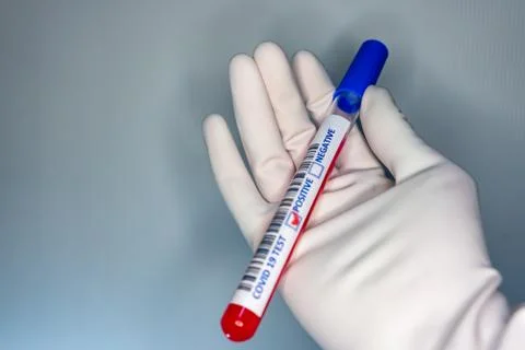Blurry image of a hand while holding a test tube containing a patients sample Stock Photos