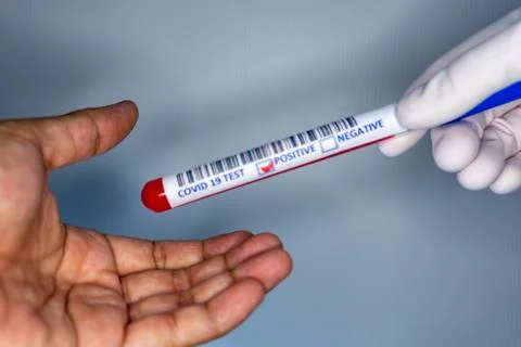 Blurry image of a hand while holding a test tube containing a patients sample Stock Photos