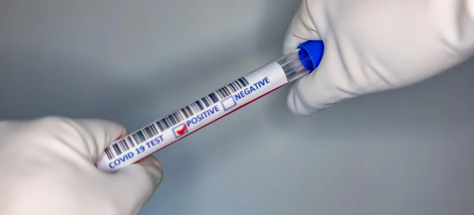 Blurry image of a nurse hands while holding a test tube containing a patients Stock Photos