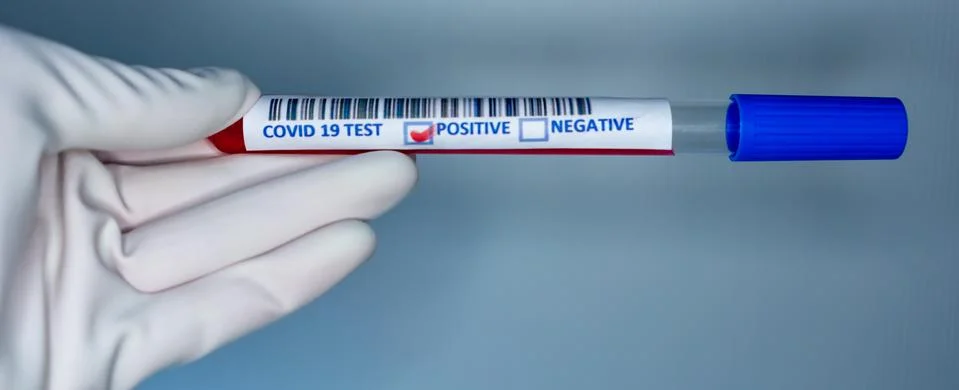Blurry image of a nurse hands while holding a test tube containing a patients Stock Photos