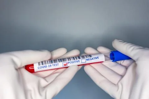 Blurry image of a nurse hands while holding a test tube containing a patients Stock Photos