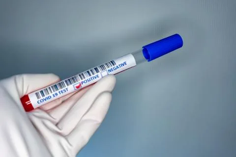 Blurry image of a nurse hands while holding a test tube containing a patients Foto stock