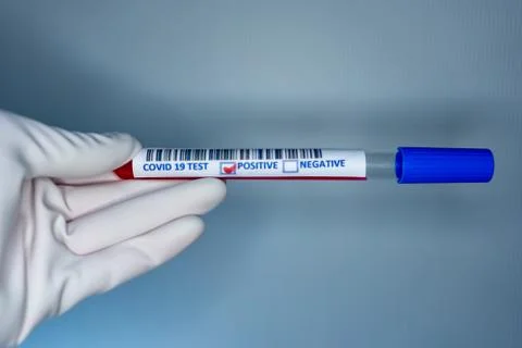 Blurry image of a nurse hands while holding a test tube containing a patients Stock Photos