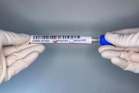 Blurry image of a nurse hands while holding a test tube containing a patients Stock Photos