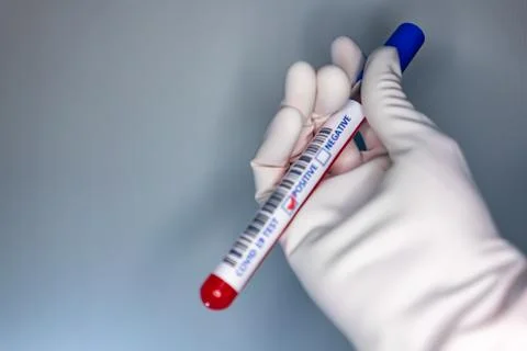 Blurry image of a nurse hands while holding a test tube containing a patients Stock Photos