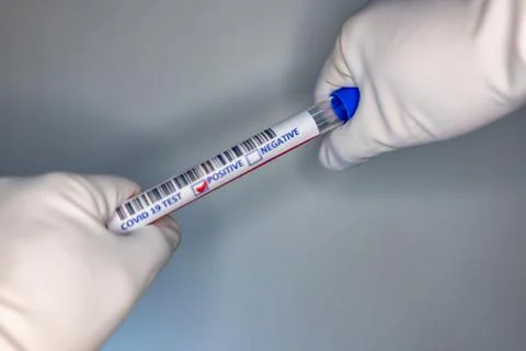 Blurry image of a nurse hands while holding a test tube containing a patients Stock Photos