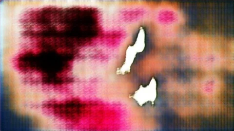 Bodily Fluids [#2.10] 库存影片 105513611