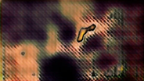 Bodily Fluids [#2.14] Stock Footage 105514057