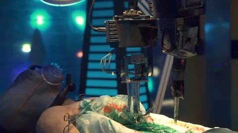 The body of an alien on the operation. Robotic arms perform the operation. There Video stock 98865590